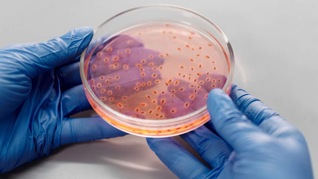 Shigella: Evolution of a Resistant Pathogen